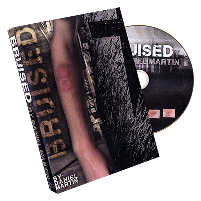 Bruised by Daniel Martin  - Trick